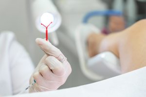 ¿Los DIU (dispositivo intrauterino) afectan a la recolección de óvulos?